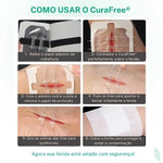 free-saude-Curativo-Para-Fechamento-de-Feridas-CuraFree-sutura-adesiva