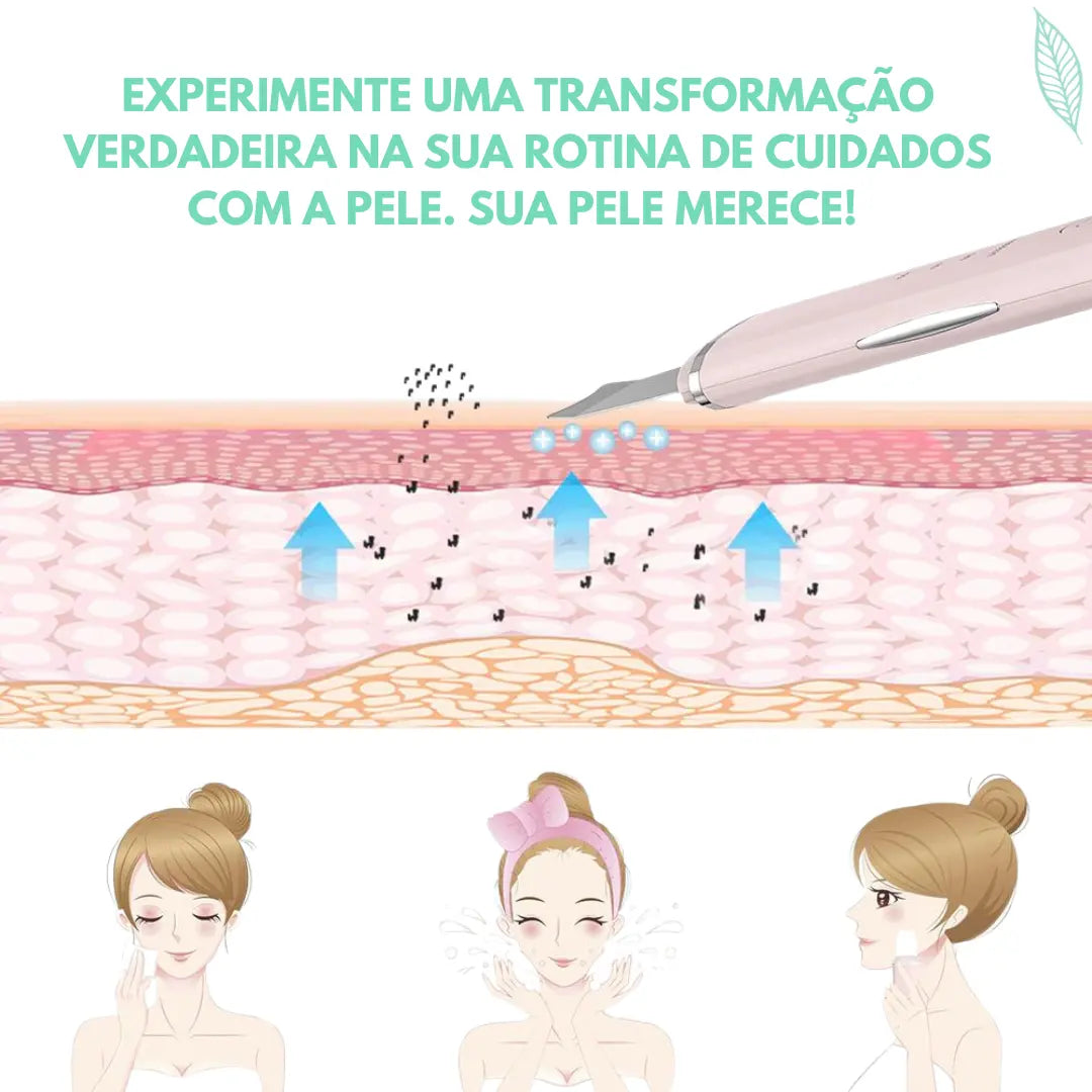 Peeling Ultrassônico de Tratamento e Limpeza Profunda RenovaSkin®