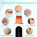 Peeling Ultrassônico de Tratamento e Limpeza Profunda RenovaSkin®