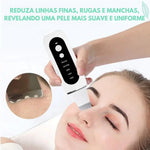 Peeling Ultrassônico de Tratamento e Limpeza Profunda RenovaSkin®